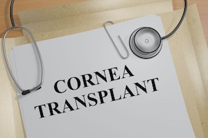 Cornea Transplant - medical concept